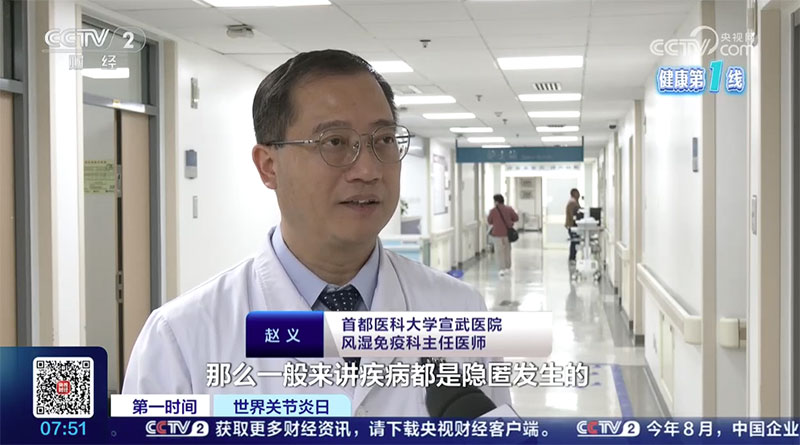 不侷限於關節的“關節炎”，這些知識需瞭解！